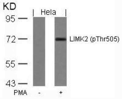 Western Blot LIM kinase 2 [p Thr505] Antibody